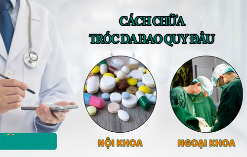 Cách chữa tróc da bao quy đầu bệnh lý hiệu quả tại Phòng khám Kiên Khang